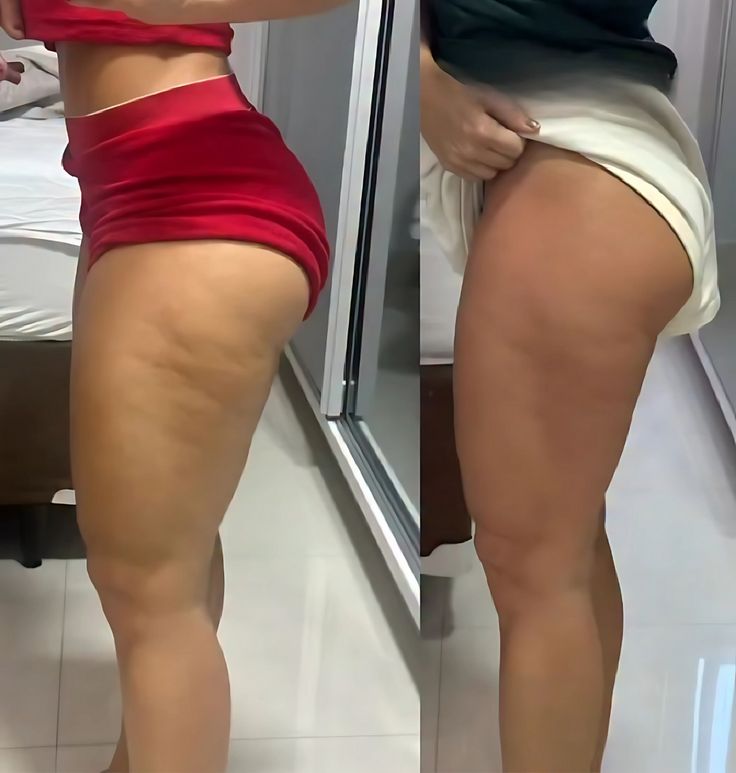 Bandes Élastiques de Fitness